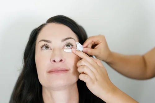 Eye care specialist applying TearCare treatment pads to patient’s eyelids for dry eye therapy